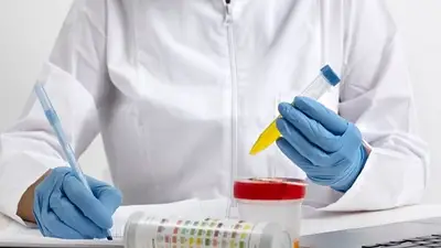 Diagnóstico de infecciones de vejiga Diagnóstico de infecciones de vejiga