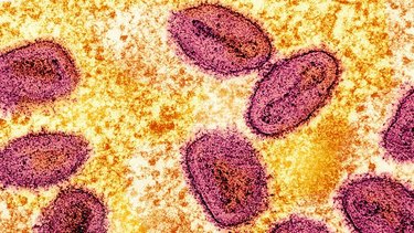 El Congo pone en marcha su primera campaña de vacunación contra la viruela símica