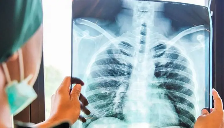Con acuerdos internacionales, La Rioja se une a un programa global para prevenir enfermedades pulmonares
