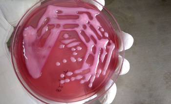 Subsidio internacional millonario a un equipo argentino que busca nuevos antimicrobianos | Resistencia a los antibióticos