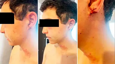 "Me sacó la oreja": el impactante testimonio del joven torturado en una estancia por sus jefes "Me sacó la oreja": el impactante testimonio del joven torturado en una estancia por sus jefes
