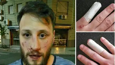 Desfiguran a un militante por haber sido de La Cámpora Desfiguran a un militante por haber sido de La Cámpora