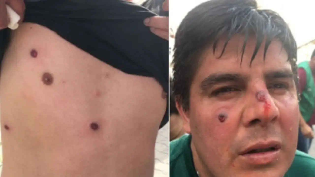 La Policía reprimió a trabajadores en Neuquén: hay heridos de gravedad