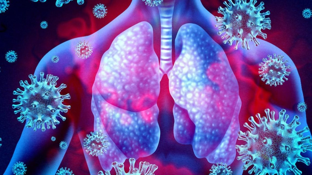 Neumonía por coronavirus: ¿qué dicen los médicos sobre las secuelas?