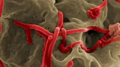 Ébola: síntomas, causas y tratamientos Ébola: síntomas, causas y tratamientos
