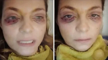 Preocupante comunicado de Tamara Paganini llena de moretones