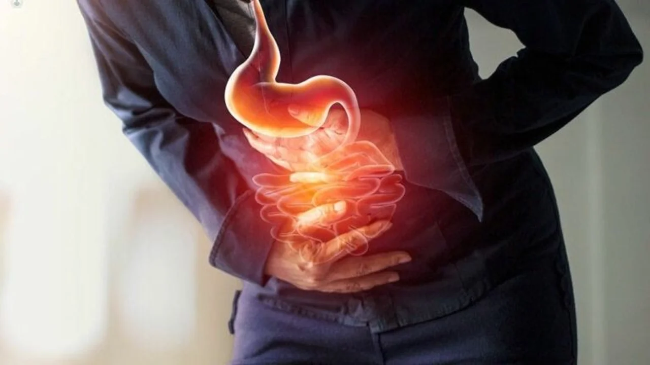 Qué es la gastritis erosiva y cómo descubrirla