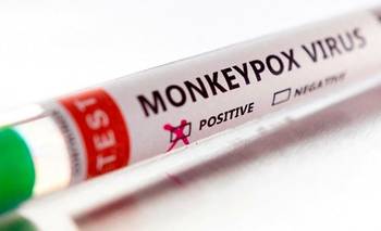 Confirman el primer caso autóctono de viruela símica en Argentina | Virus de la viruela símica