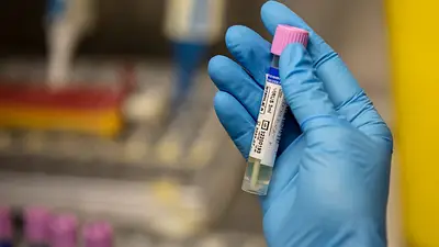 La OMS investiga 25 familias de virus y bacterias que pueden provocar futuras pandemias La OMS investiga 25 familias de virus y bacterias que pueden provocar futuras pandemias
