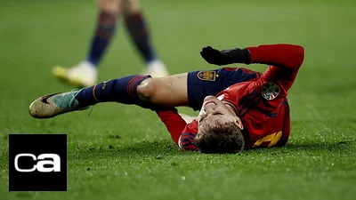Jugador del Barcelona Gavi estará de baja varios meses por rotura del ligamento cruzado anterior Jugador del Barcelona Gavi estará de baja varios meses por rotura del ligamento cruzado anterior
