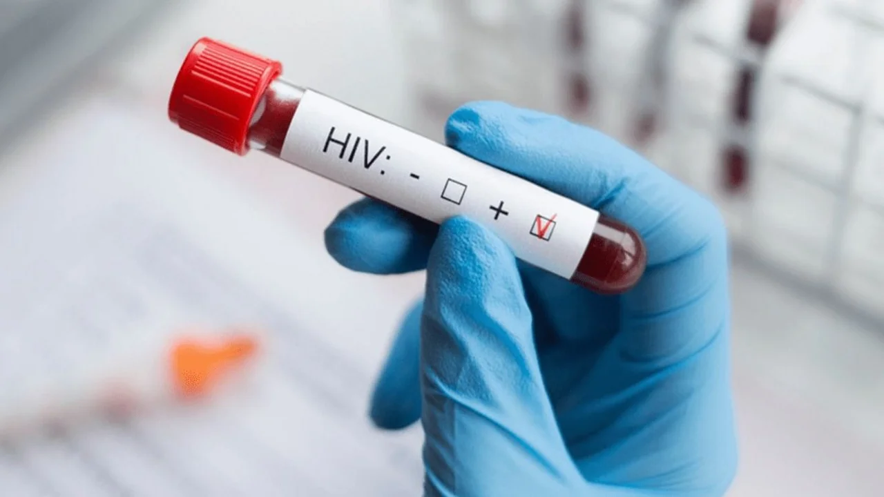 Grave ajuste de Milei en salud: faltan reactivos para medir carga viral de VIH 