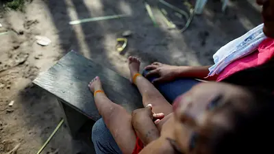 Científicos intentan demostrar relación entre extracción de oro en Amazonia y discapacidades en bebés Científicos intentan demostrar relación entre extracción de oro en Amazonia y discapacidades en bebés
