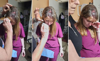 Atacó a una veterinaria con una tenaza en Córdoba | Córdoba 