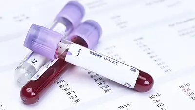 Tubo de ensayo con sangre Tubo de ensayo con sangre