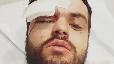 Una patota atacó a un rugbier por ser gay: "Te vamos a matar por puto" Una patota atacó a un rugbier por ser gay: "Te vamos a matar por puto"