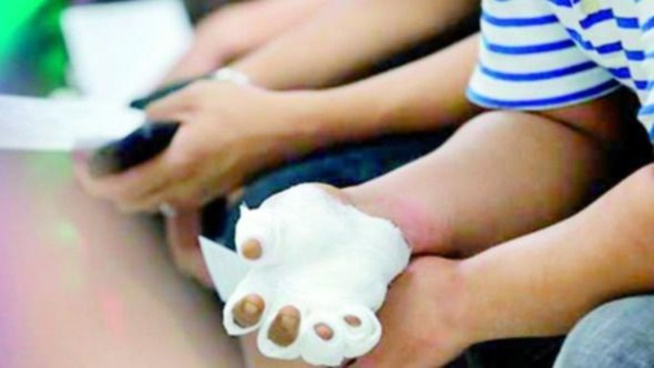 Navidad 2019: 13 accidentados por el uso de pirotecnia, la cifra más baja de los últimos años