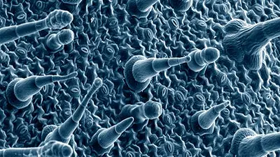 Herpes genital: tratamientos, síntomas y prevención Herpes genital: tratamientos, síntomas y prevención