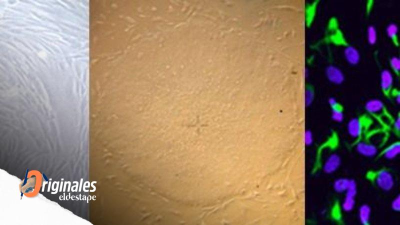 Por primera vez, reprograman células de piel y las transforman en neuronas
