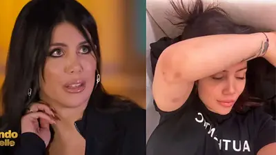 Preocupación por la salud de Wanda Nara: la foto que encendió las alarmas. Preocupación por la salud de Wanda Nara: la foto que encendió las alarmas.