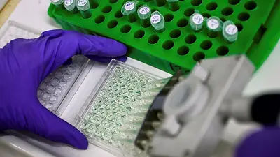 La terapia contra el cáncer de próstata de Candel cumple objetivo en la última fase de ensayo La terapia contra el cáncer de próstata de Candel cumple objetivo en la última fase de ensayo
