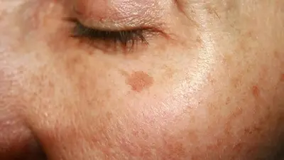 piel, manchas, arrugas, maquillaje piel, manchas, arrugas, maquillaje