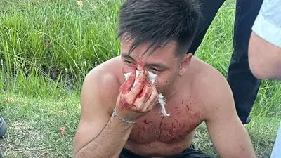 Golpes y racismo de rugbiers a un joven en una fiesta de Navidad en Mendoza: "Bolivianito" Golpes y racismo de rugbiers a un joven en una fiesta de Navidad en Mendoza: "Bolivianito"