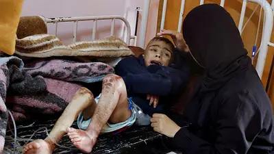 Los expertos piden que se redefina la hambruna ante el sufrimiento en Gaza Los expertos piden que se redefina la hambruna ante el sufrimiento en Gaza