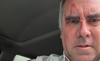 Balearon a un precandidato presidencial de Perú pero resultó ileso  | Perú