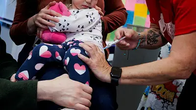 EEUU revisa las terapias contra el virus sincicial en niños EEUU revisa las terapias contra el virus sincicial en niños