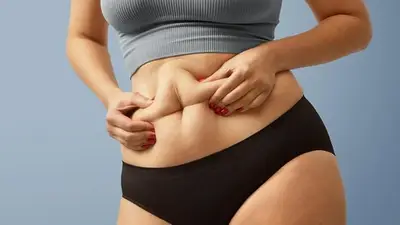 Grasa abdominal Grasa abdominal