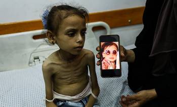 Más de 1.000 palestinos murieron en Gaza desde julio de 2024 esperando evacuación médica | Conflicto en medio oriente