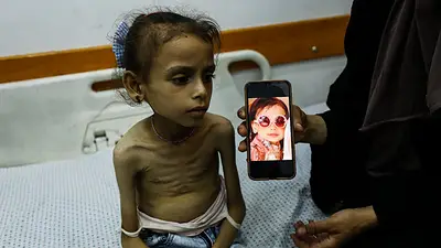 Niña palestina en un hospiral Niña palestina en un hospiral