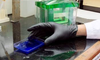 Descubren en Argentina la causa genética de un colesterol "bueno" defectuoso | Salud